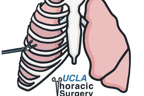UCLA Thoracic Surgery Interest Group Logo