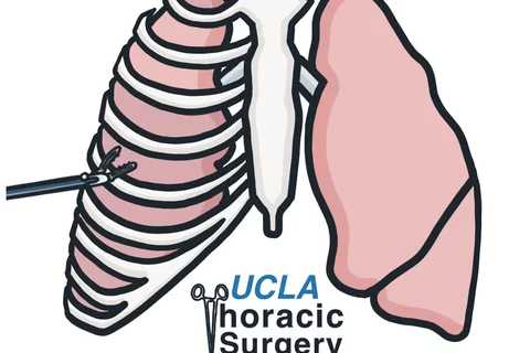 UCLA Thoracic Surgery Interest Group Logo